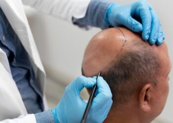 Fakta Stres Picu Kebotakan, Begini Penjelasan Dosen IPB University